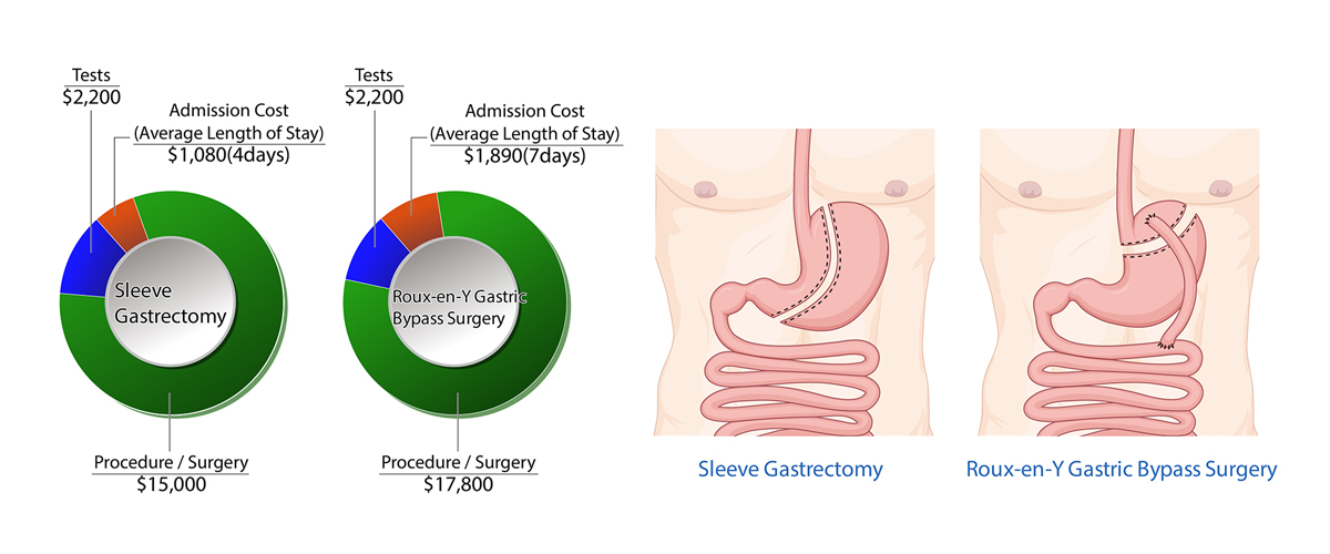 Bariatric Surgery