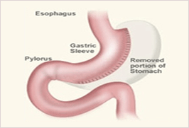 Bariatric Clinic - Gachon University Gil Hospital Mobile